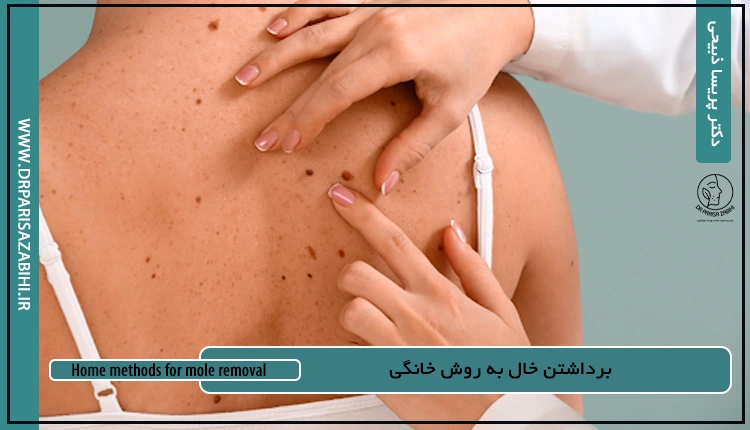 برداشتن خال به روش خانگی 2 Home methods for mole removal