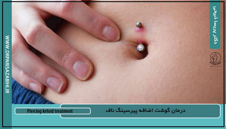 درمان گوشت اضافه پیرسینگ ناف 2 Piercing keloid treatment