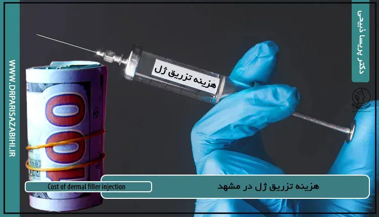 هزینه تزریق ژل در مشهد ۱۴۰۵ | لیست قیمت ژل لب و گونه 6 Cost of dermal filler injection