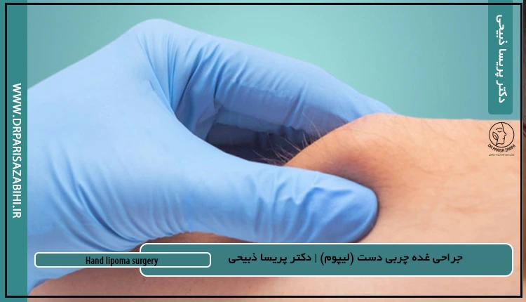 جراحی غده چربی دست (لیپوم)؛ تشخیص، درمان و تفاوت با کیست مچ 2 جراحی غده چربی دست (لیپوم)