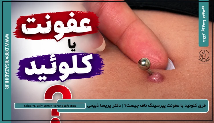 فرق کلوئید با عفونت پیرسینگ ناف چیست؟