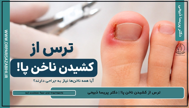 ترس از کشیدن ناخن پا! آیا همه ناخن‌ها نیاز به جراحی دارند؟ترس از کشیدن ناخن پا! آیا همه ناخن‌ها نیاز به جراحی دارند؟
