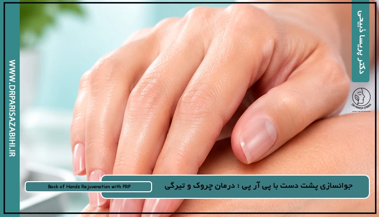 پوست و مو، ژل، بوتاکس و جراحی محدود مشهد 14 جوانسازی پشت دست با پی آر پی (PRP)؛ درمان چروک و تیرگی