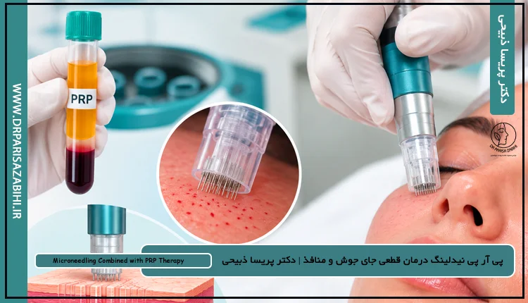 پی آر پی نیدلینگ چیست؟ (درمان قطعی جای جوش و منافذ) + هزینه