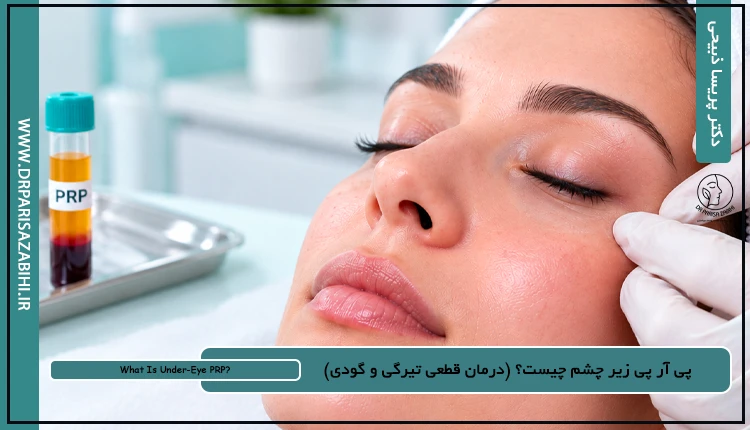 پی آر پی زیر چشم چیست؟ (درمان قطعی تیرگی و گودی)